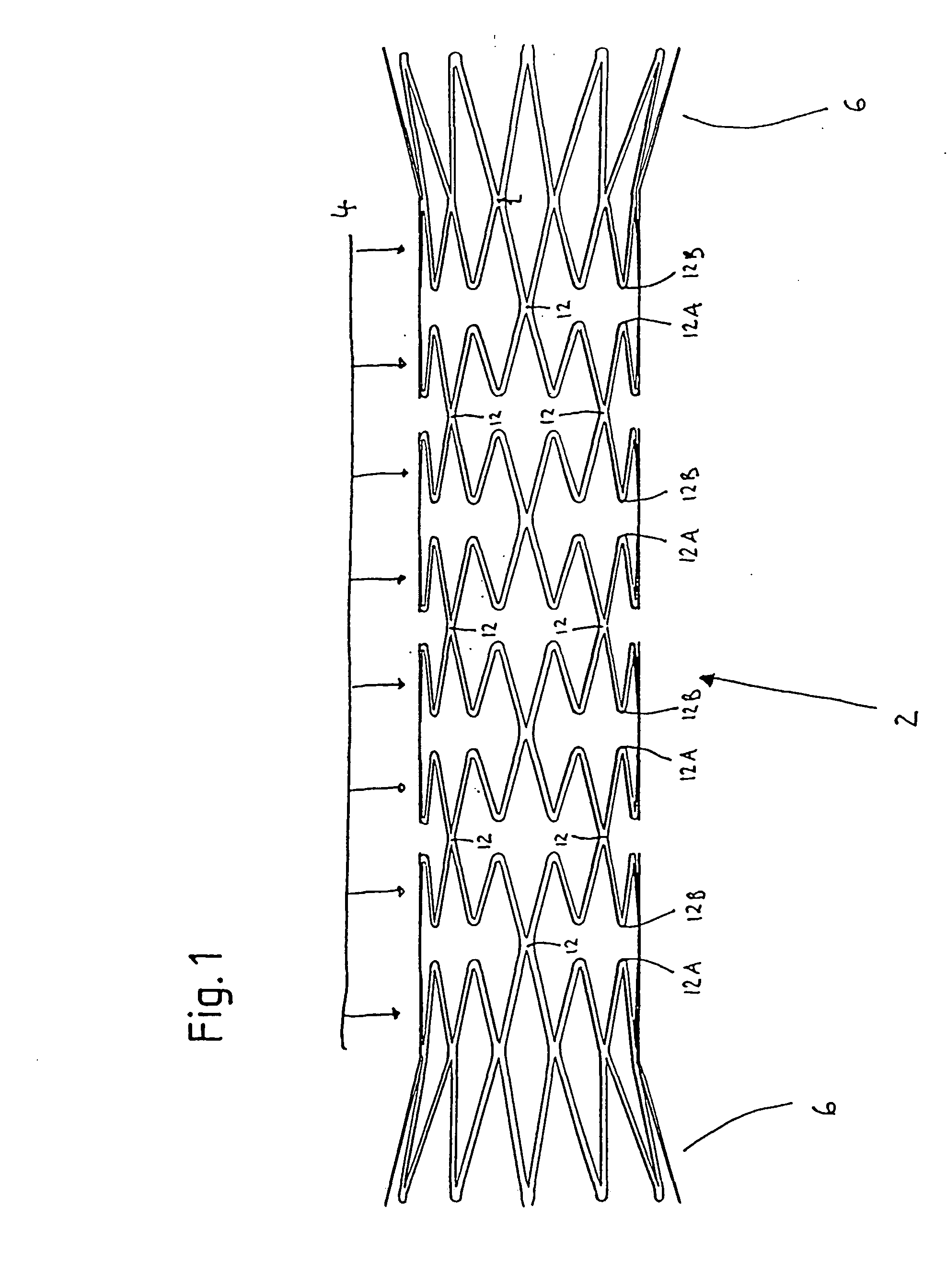 Metal structure compatible with mri imaging, and method of manufacturing such a structure