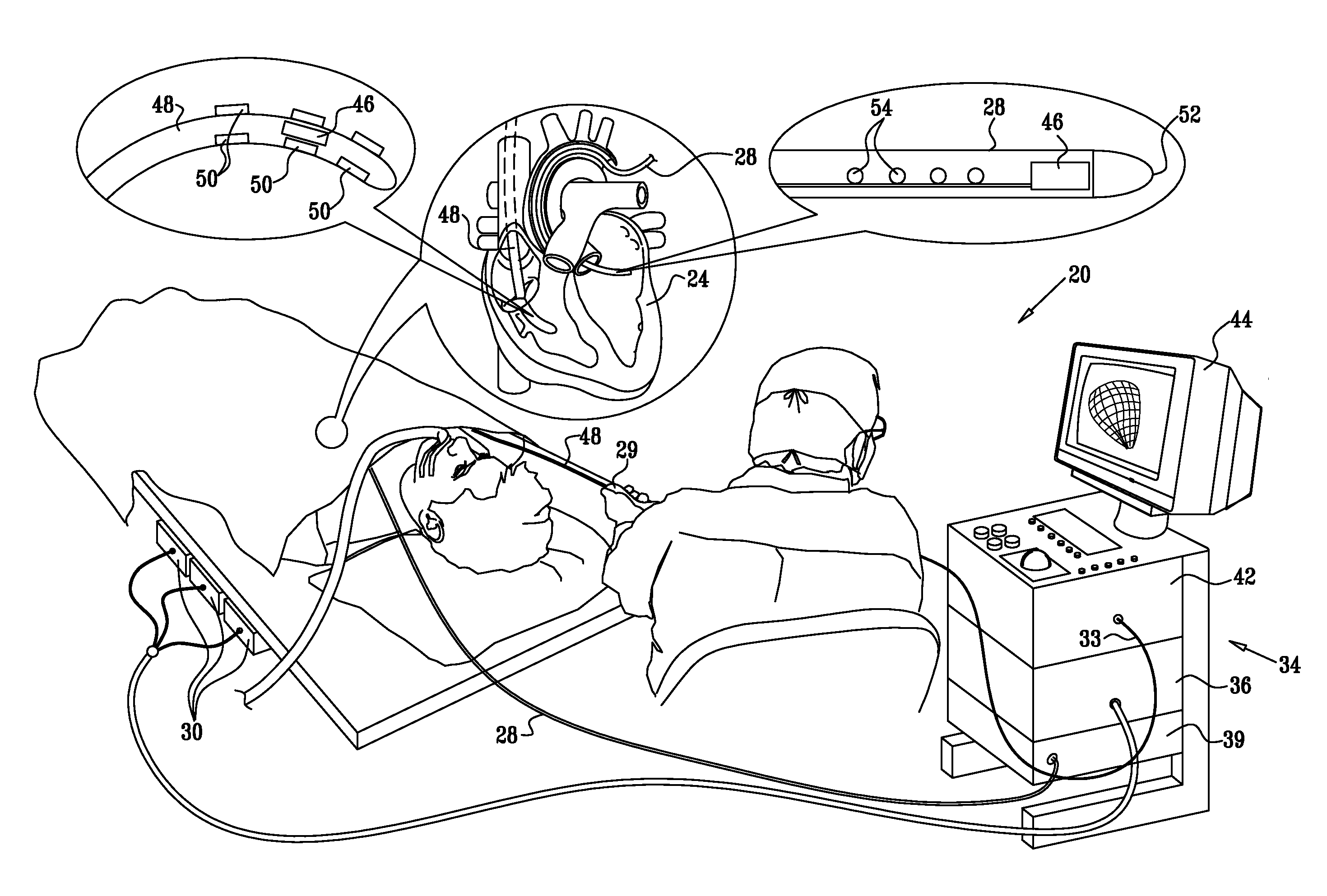 Coloring electroanatomical maps to indicate ultrasound data acquisition