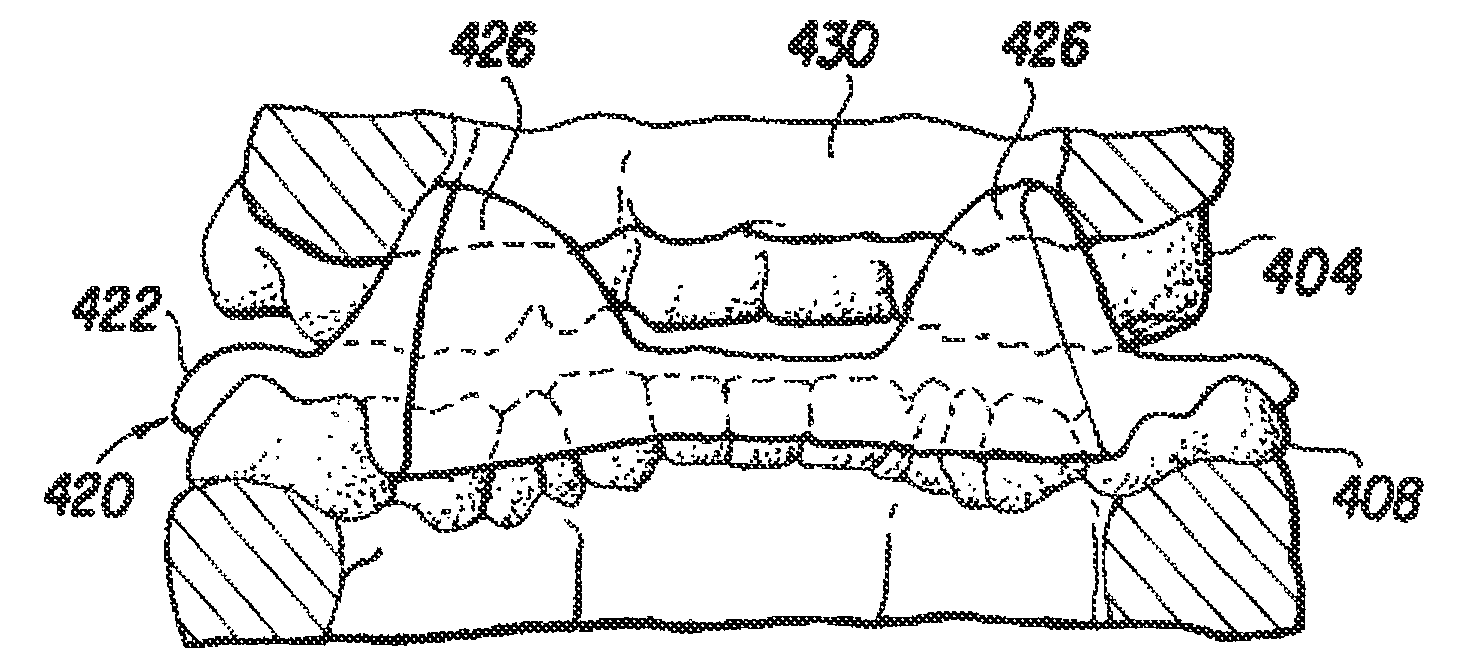 Birthing aid: method of using musculoskeletal repositioning device