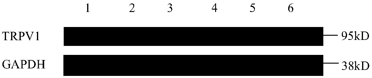 Pharmaceutical composition for treating diarrhea-predominant irritable bowel syndrome