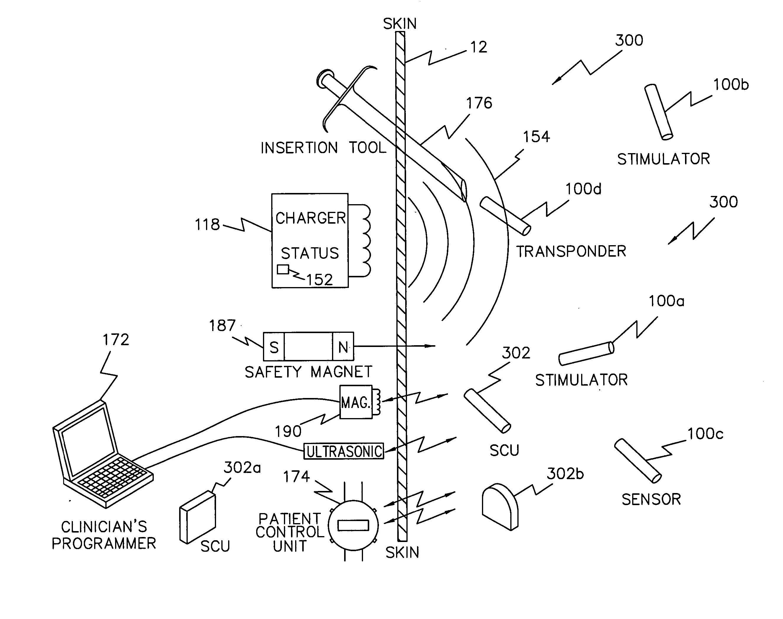 System and method for sharing a common communication channel between multiple systems of implantable medical devices