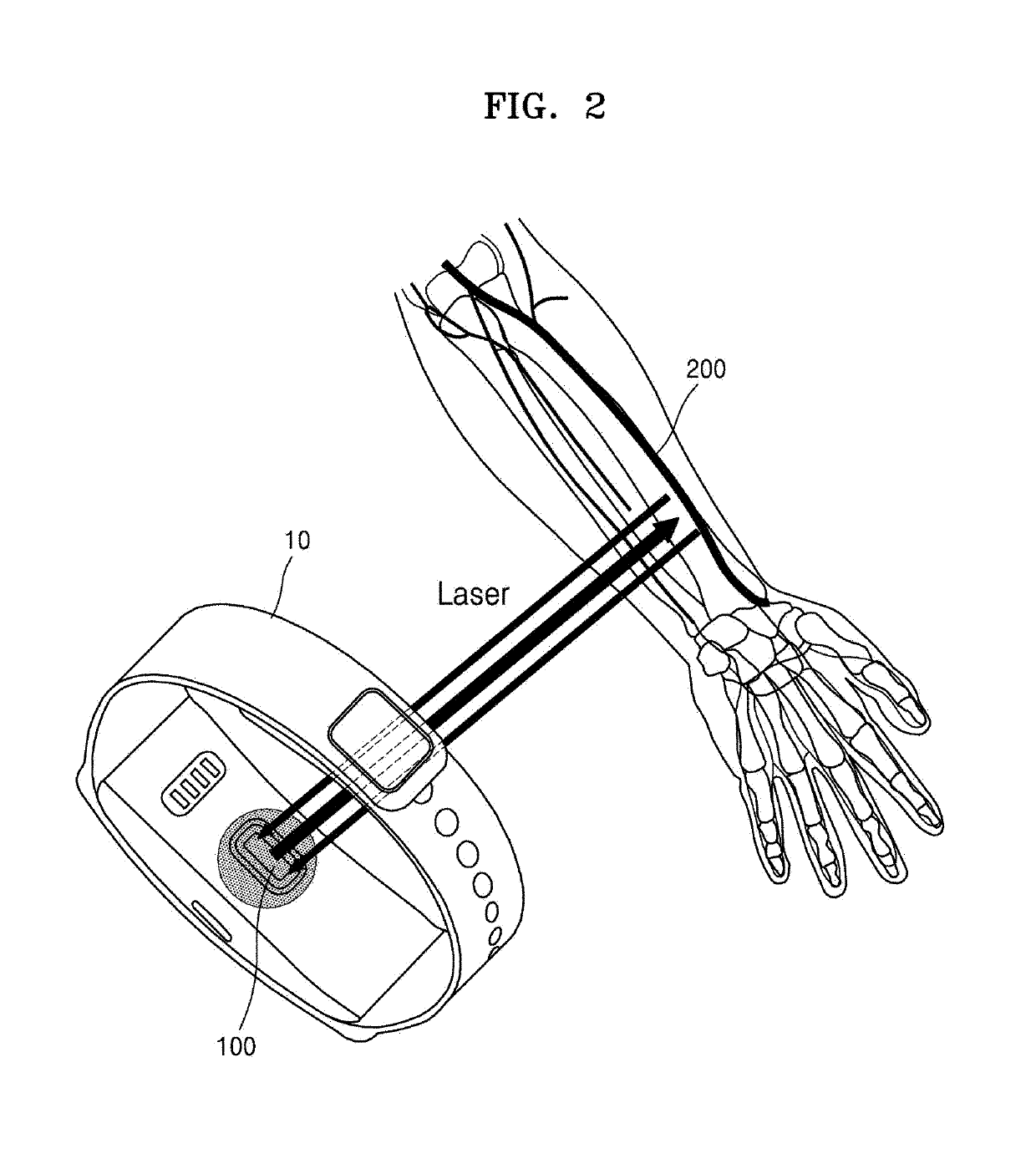 Apparatus for and method of monitoring blood pressure and wearable device having function of monitoring blood pressure