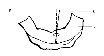 Method for preparing positioning guide plate of oral and dental implants