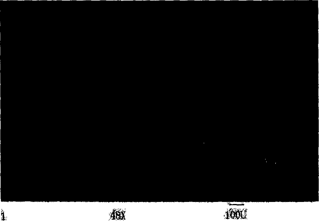 Chitosan microcapsule and its preparation method and uses