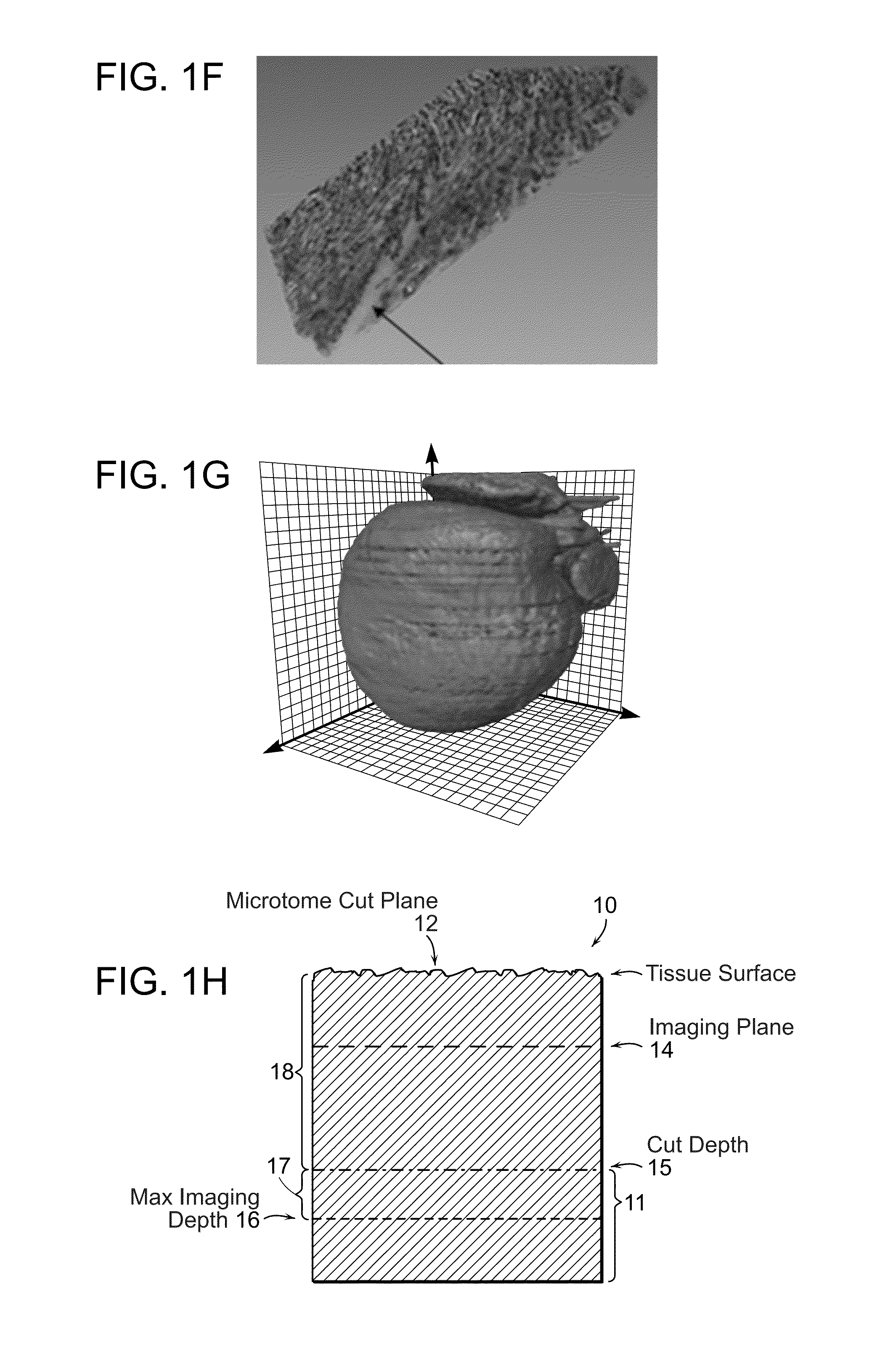 Systems and methods for imaging and processing tissue