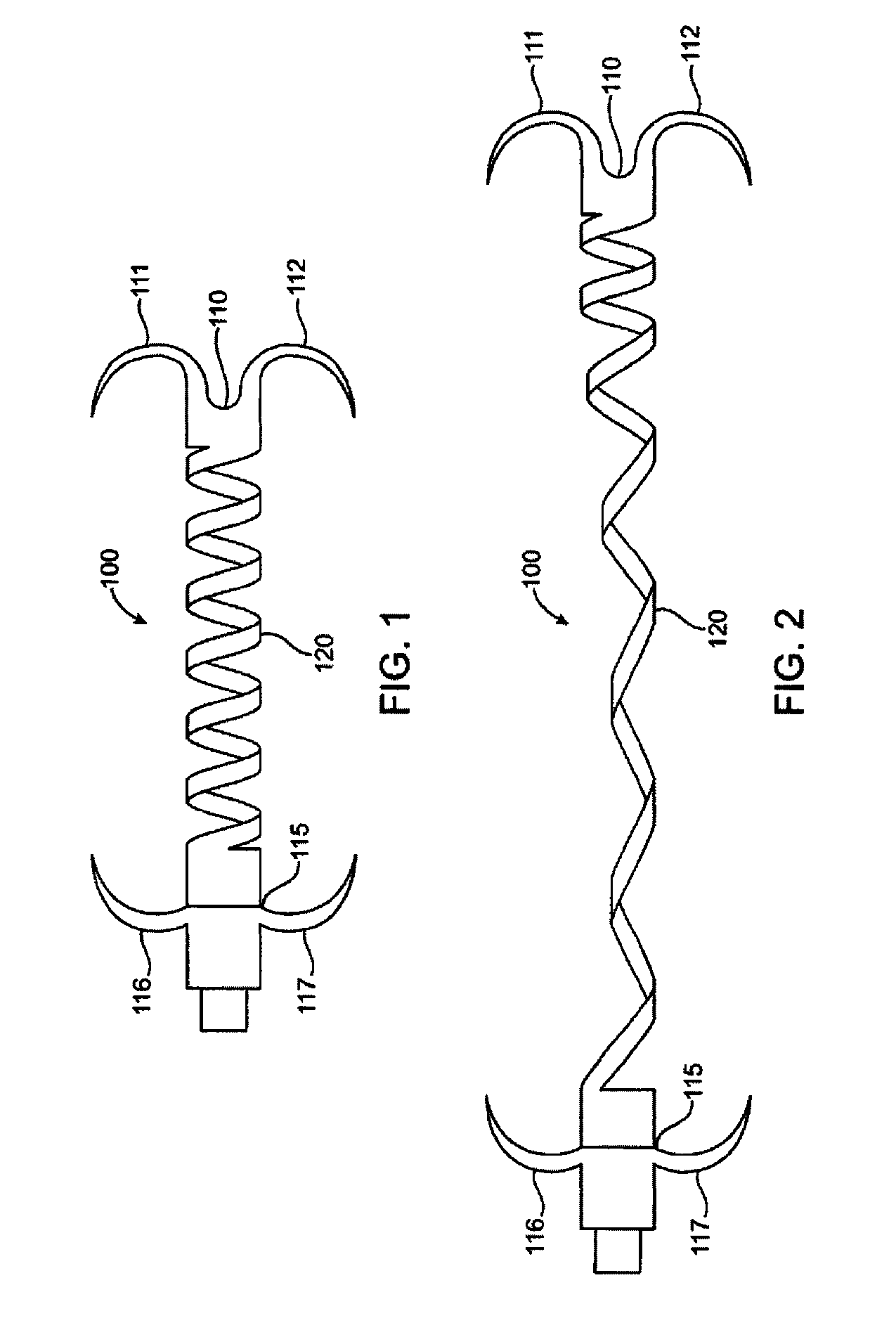 Device for Treating Mitral Valve Regurgitation