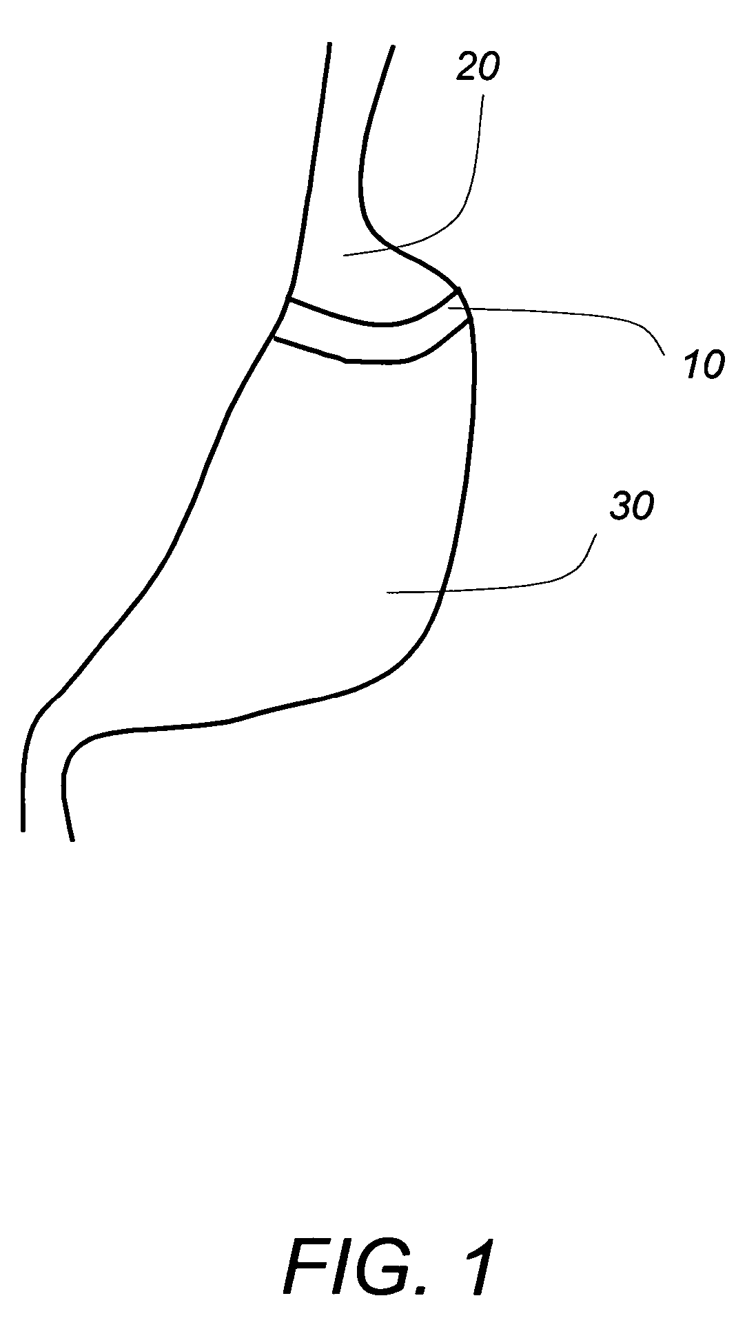 Gastric band insertion instrument