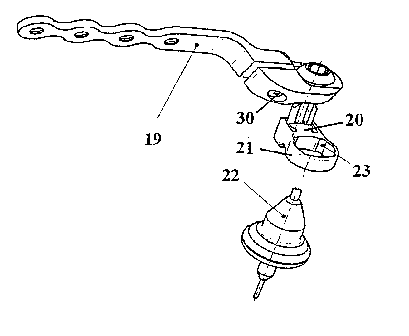 At least partially implantable hearing system