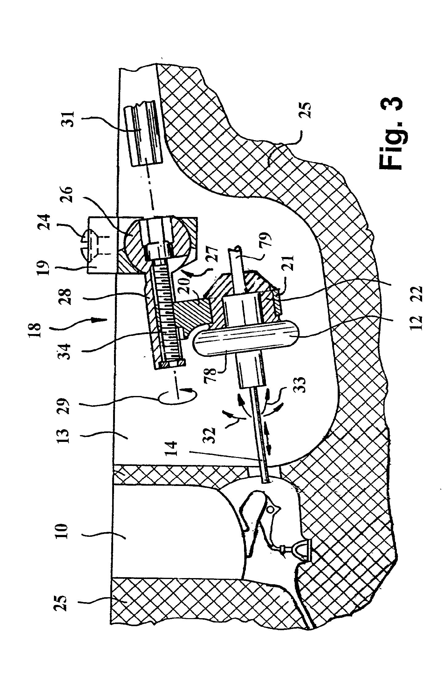 At least partially implantable hearing system