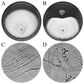 Bacillus paralicheniformis ZYGT1811 and application thereof