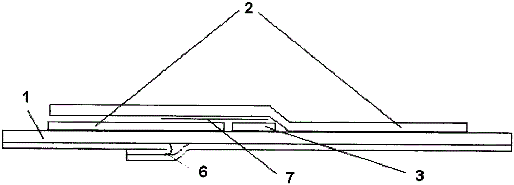 Y-shaped remaining needle catheter fixing device