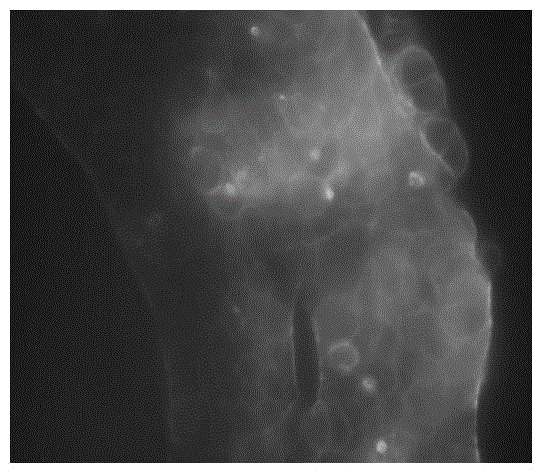 Application of salsalate compound in preparing drugs for restraining metastases and diffusion of colon cancer cells