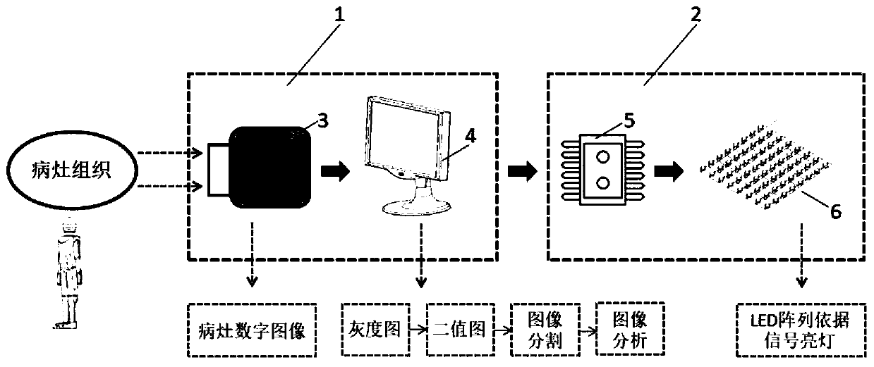 Intelligent photodynamic therapy illumination system based on LED array