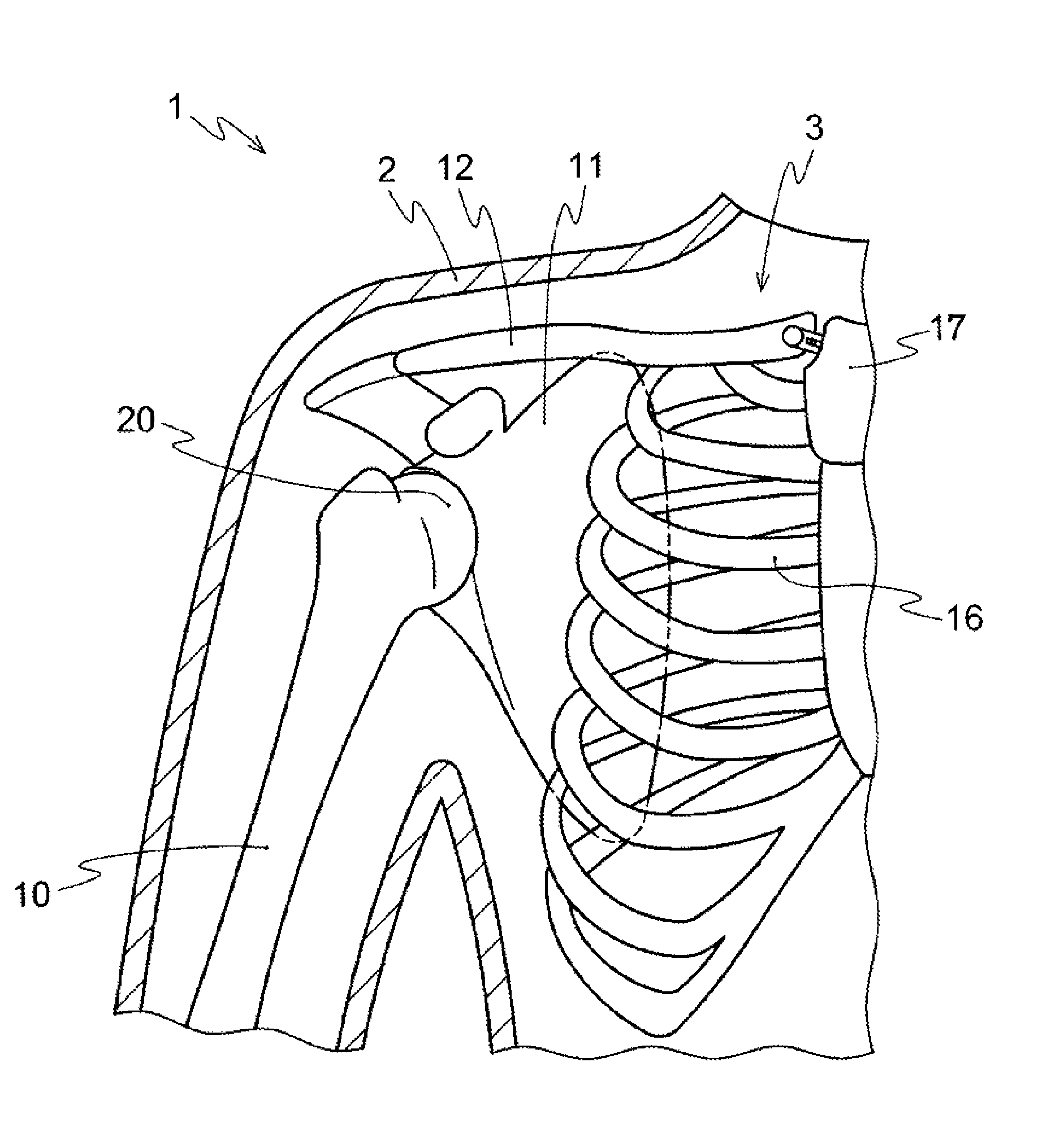 Anatomical model for training aid for learning reduction techniques and a method for learning the reduction techniques using the anatomical model for training aid