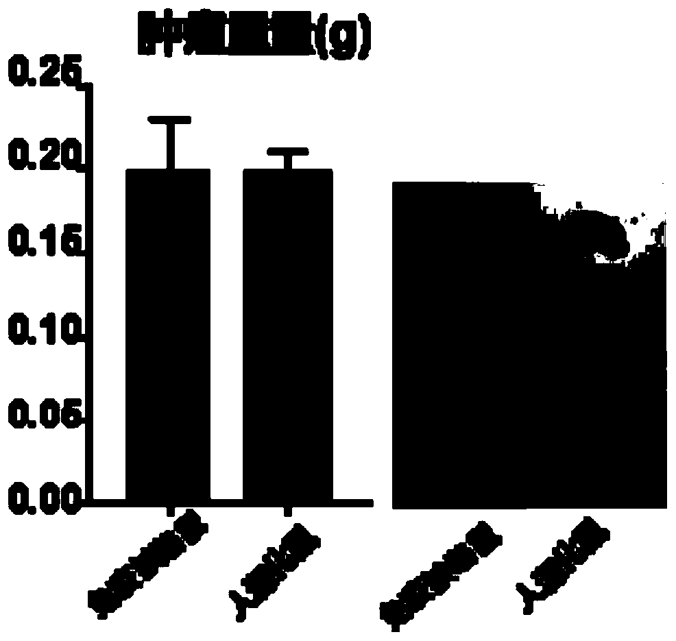 Constructed humanized mouse tumor model and preparation method and application thereof