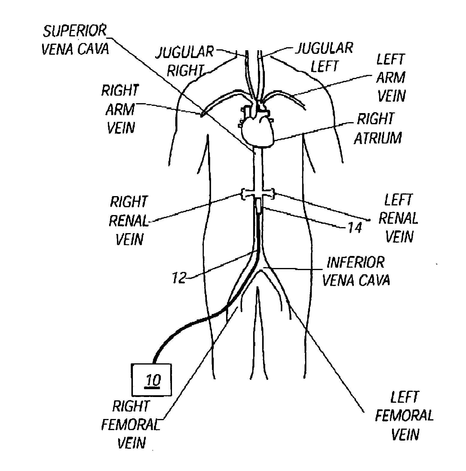 Medical procedure