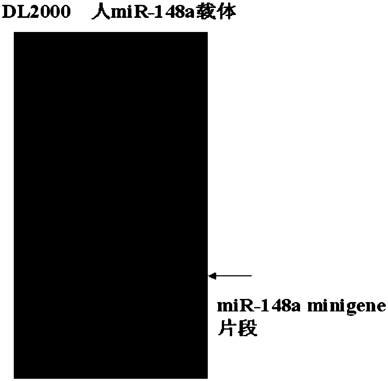 Application of human mir-148a in the preparation of drugs for improving insulin sensitivity of adipocytes