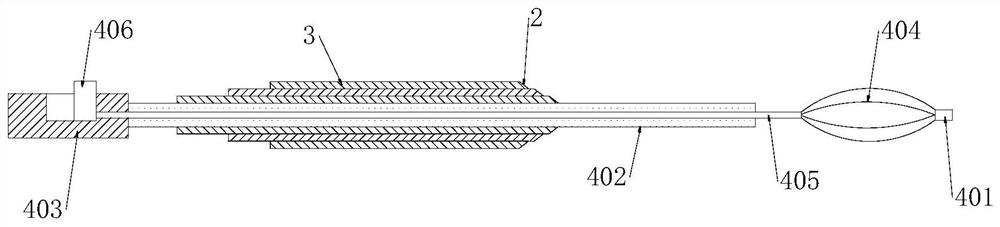 Continuous expanding type fascia dilator for percutaneous nephroscope surgery