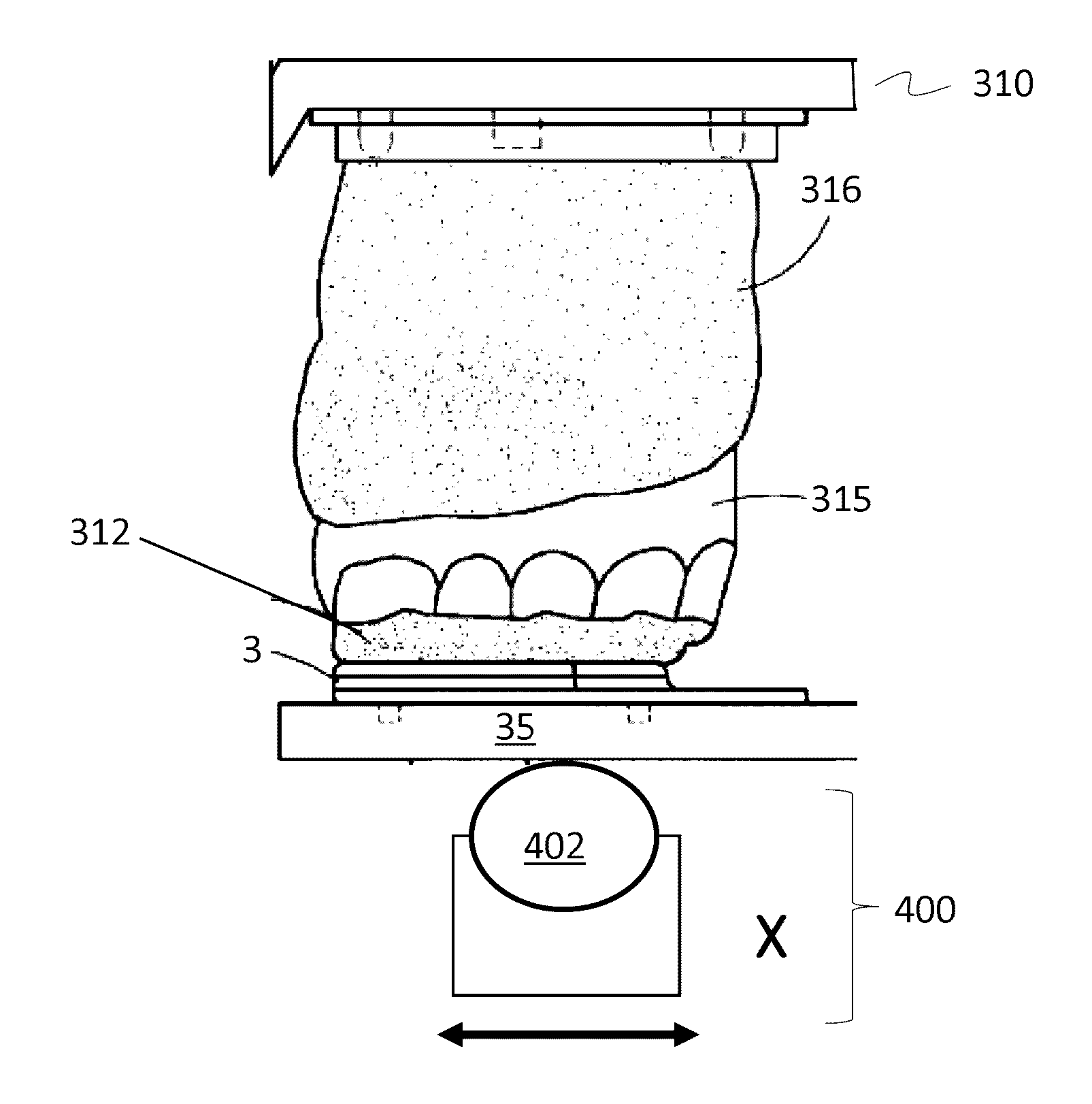 Digital face bow system and method