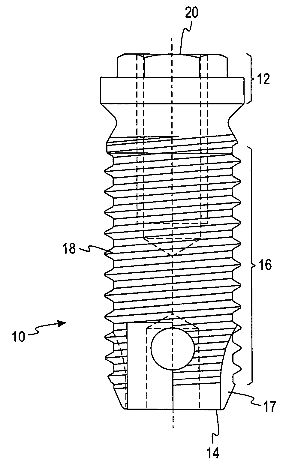 Deposition of discrete nanoparticles on an implant surface