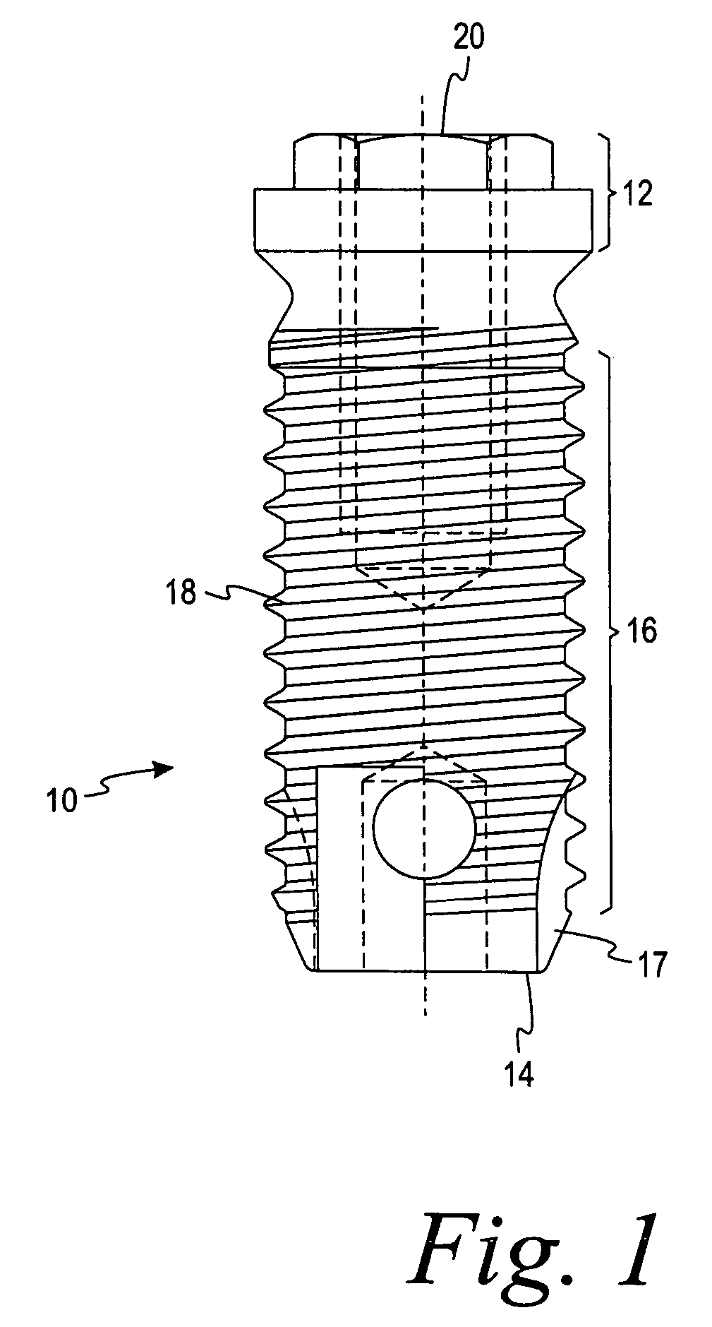 Deposition of discrete nanoparticles on an implant surface