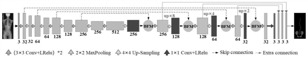 A Method for Automatic Segmentation and Labeling of X-ray Spine