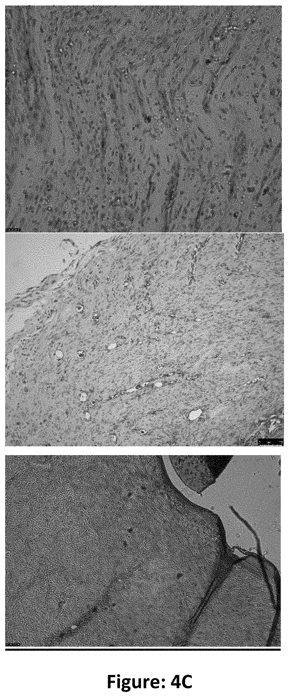 Recombinant TGF a for wound healing purposes, and the process thereof