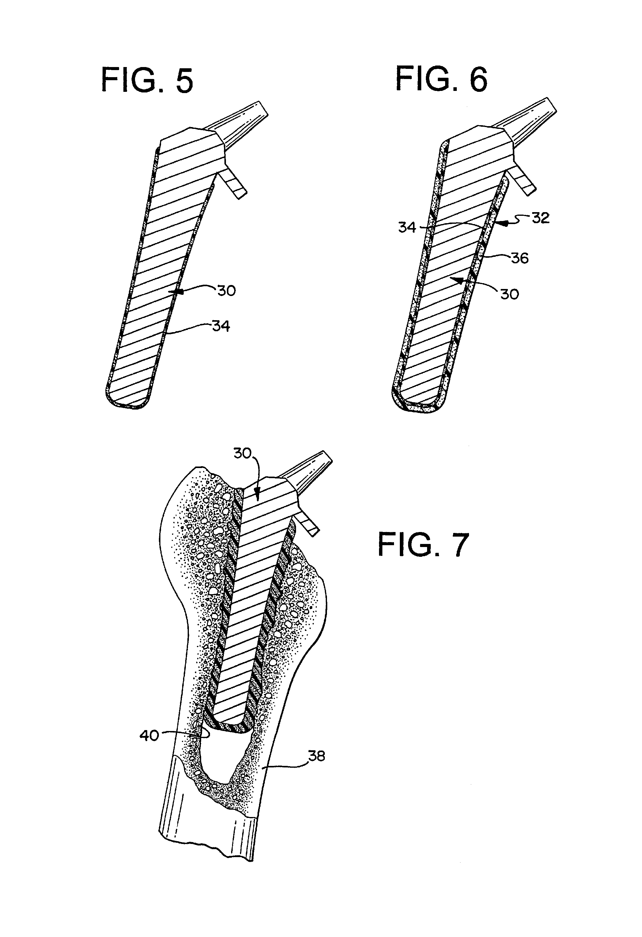 Appliance with bilayer base