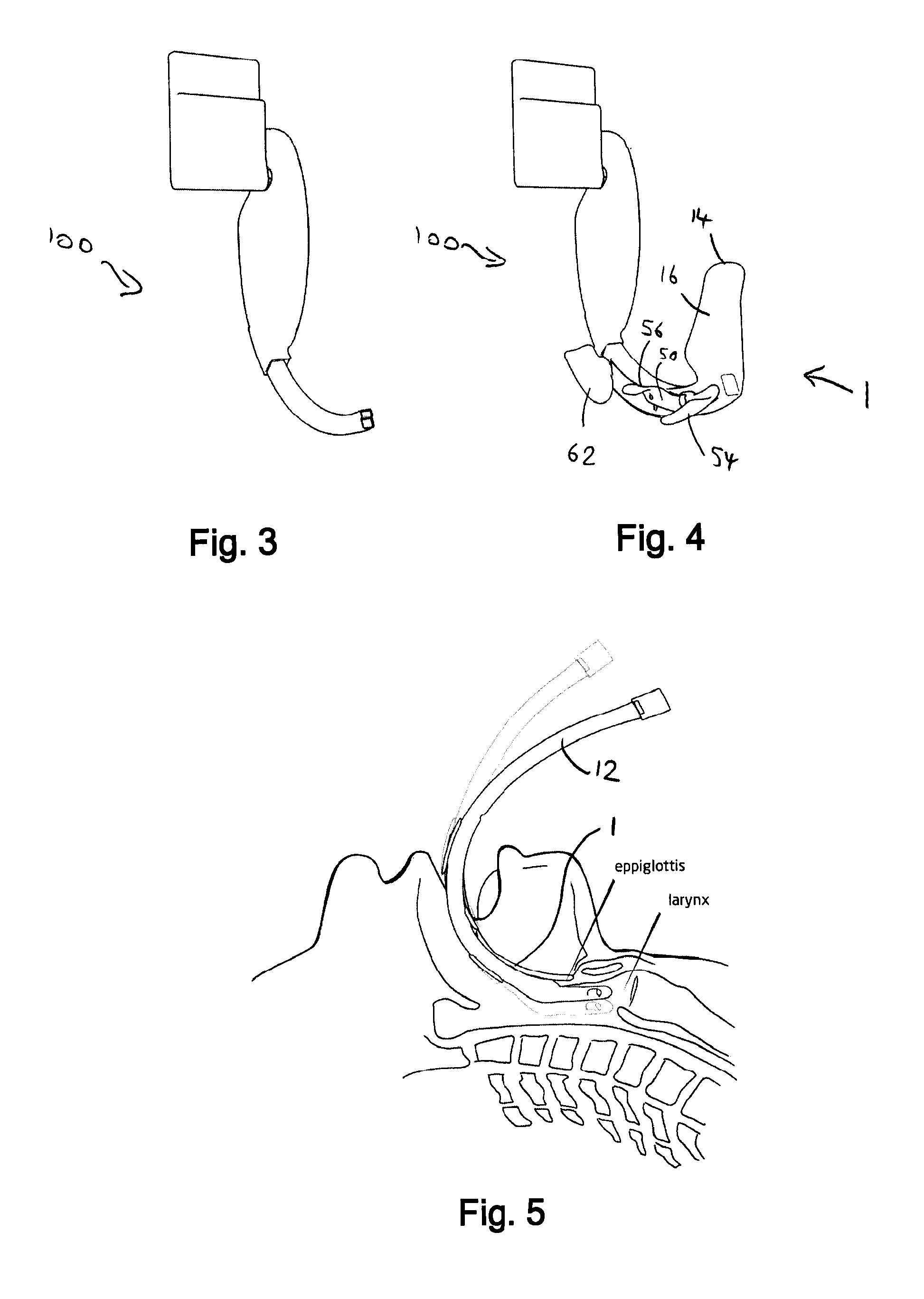 Insertion section for laryngoscope with lateral tube guide