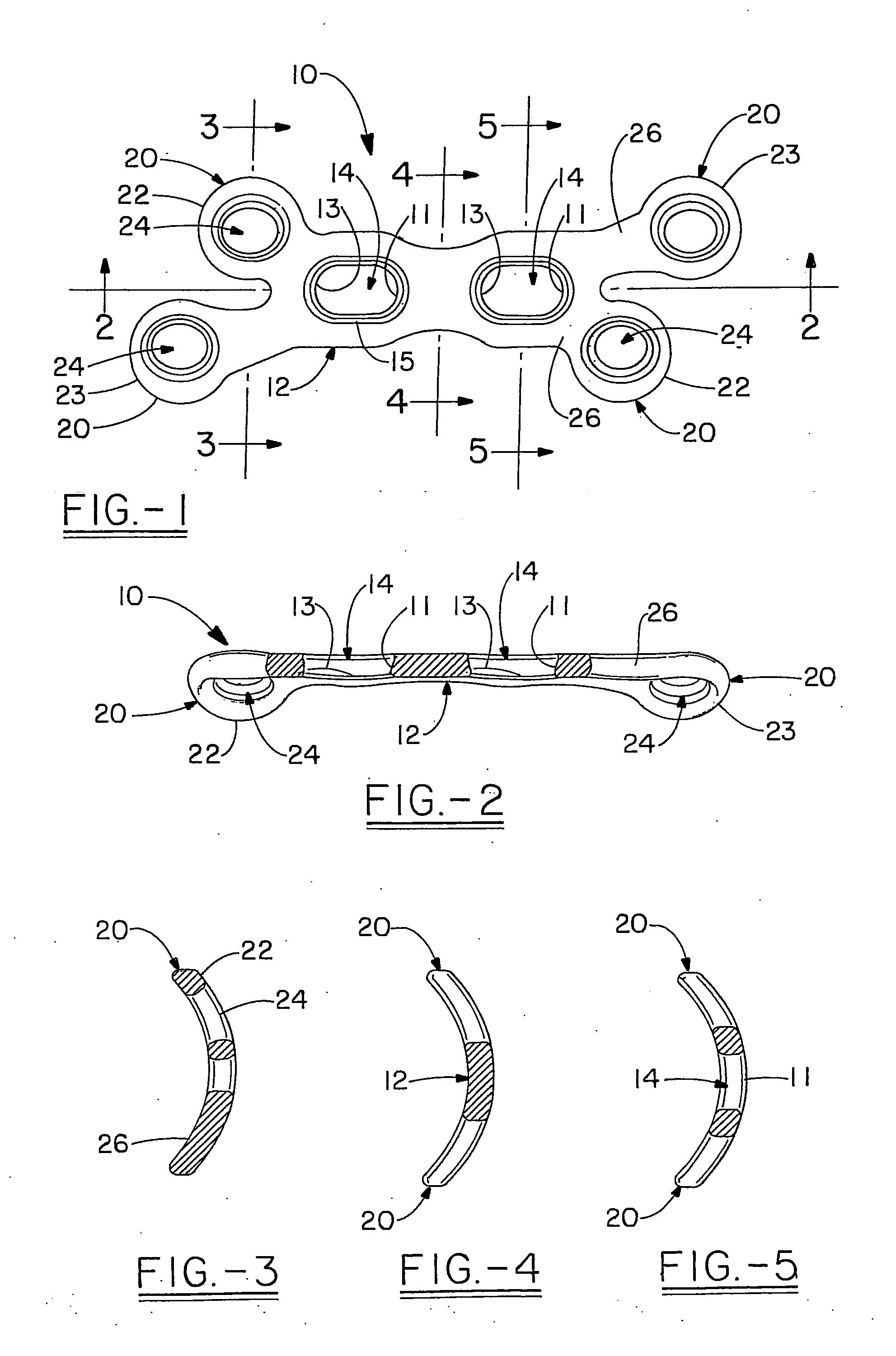 Orthopedic plate for use in fibula repair