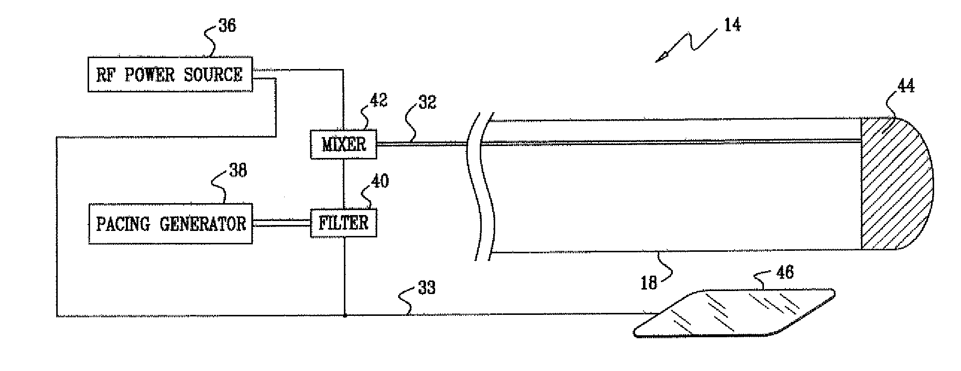 Filter for simultaneous pacing and ablation