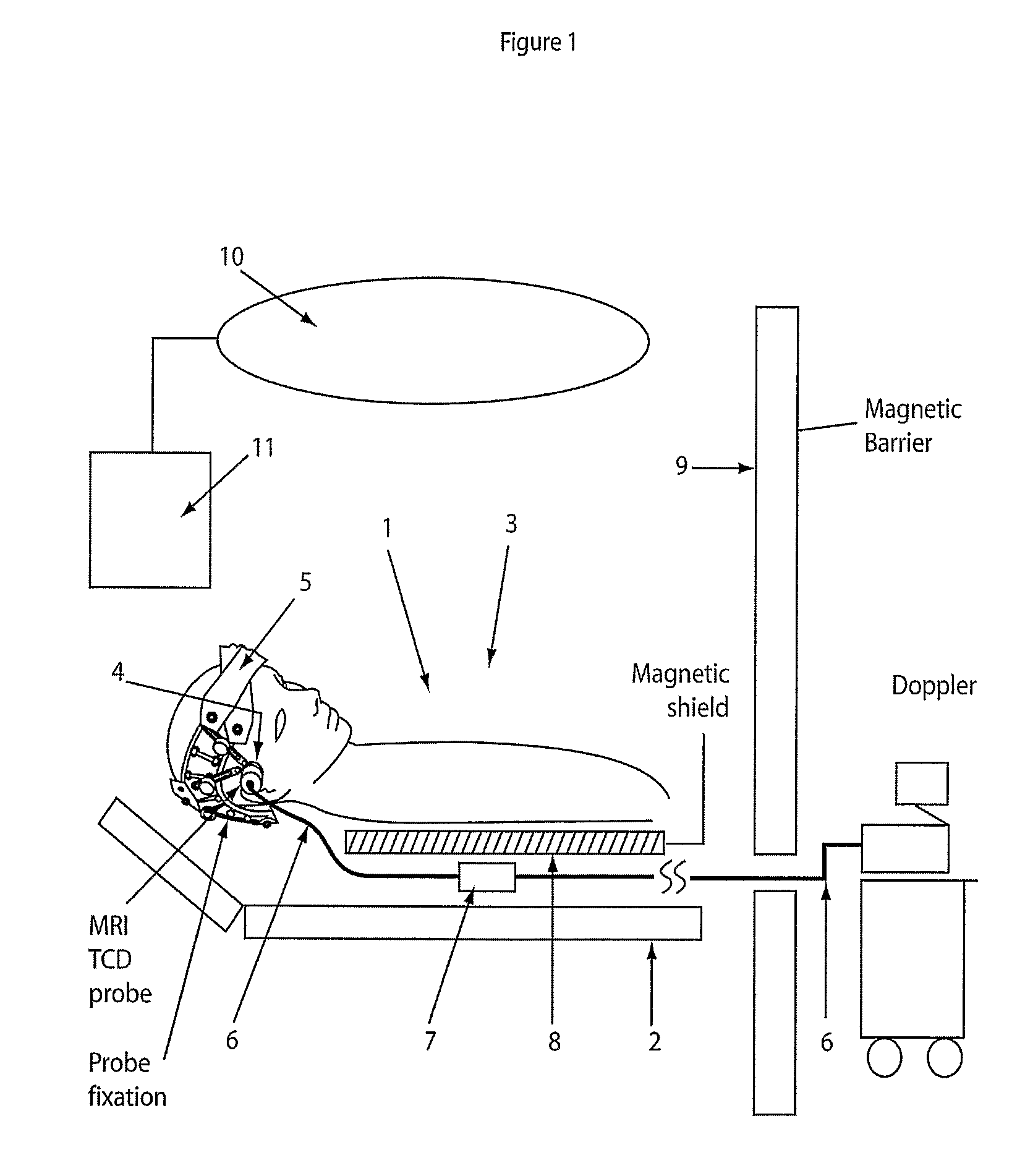 Ultrasound in magnetic spatial imaging apparatus