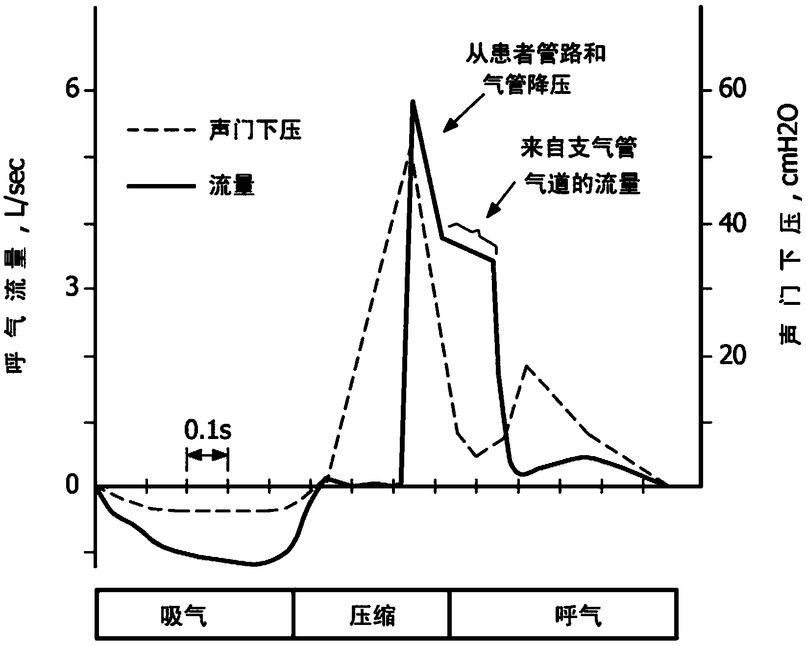 Method and apparatus for assisting airway clearance