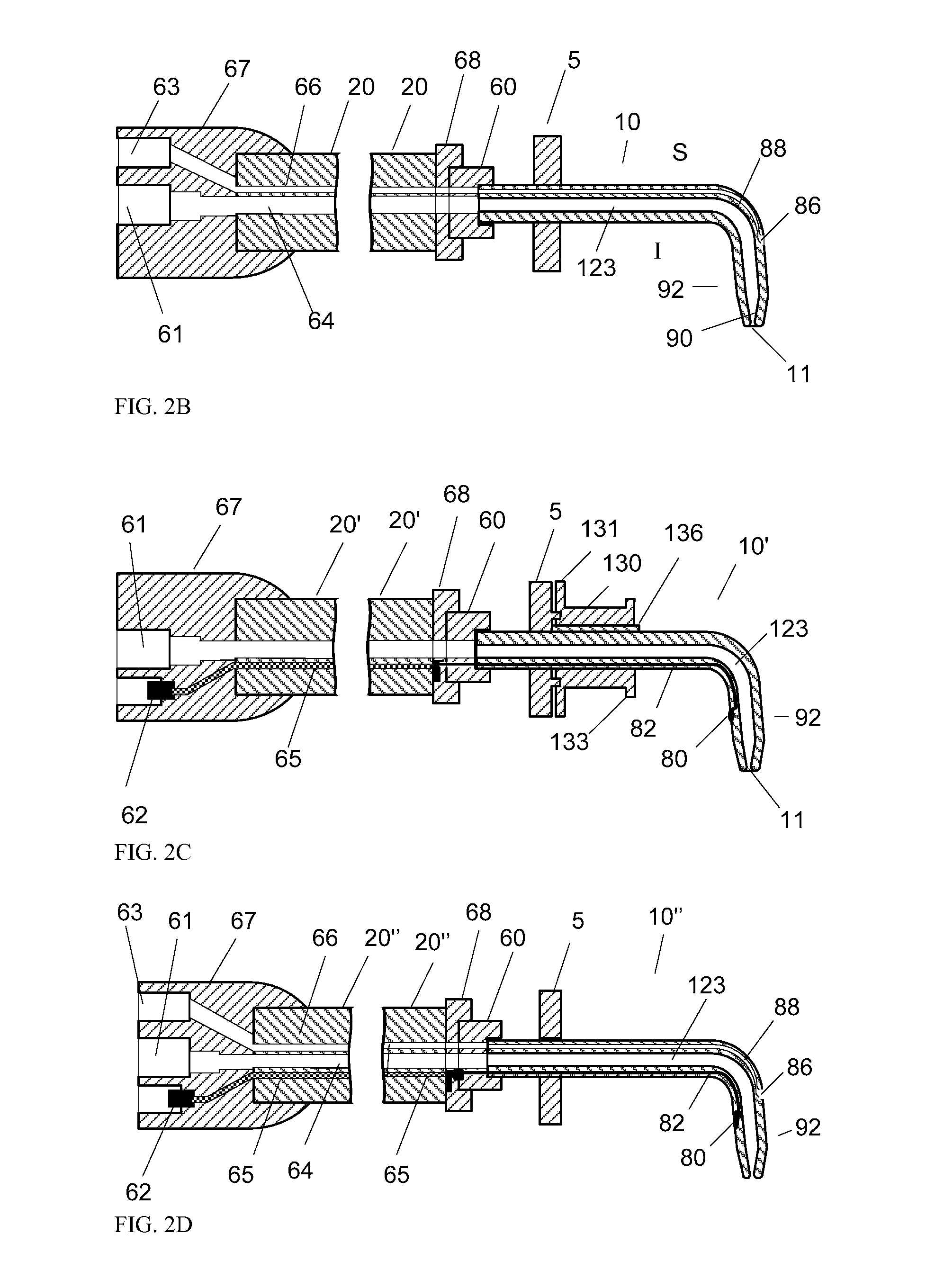 Methods and devices for treating sleep apnea