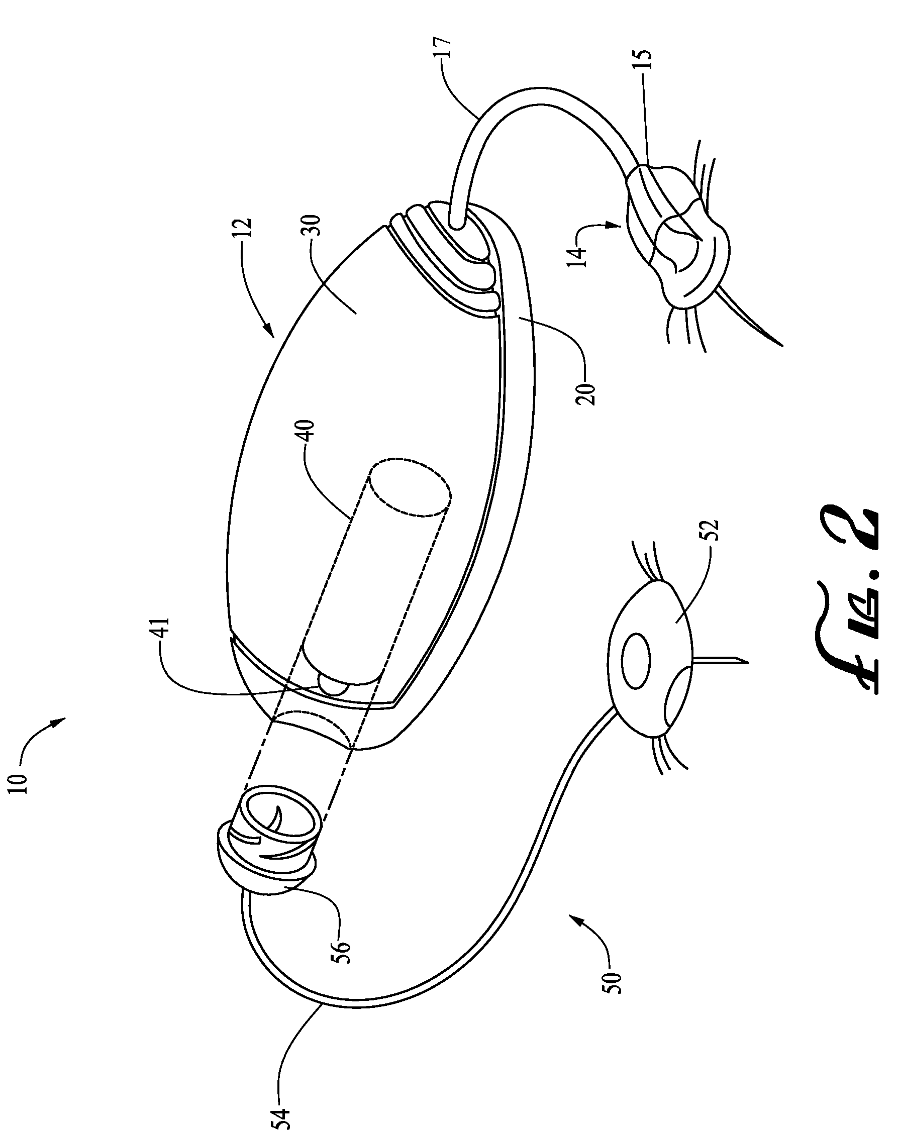 Alignment systems and methods