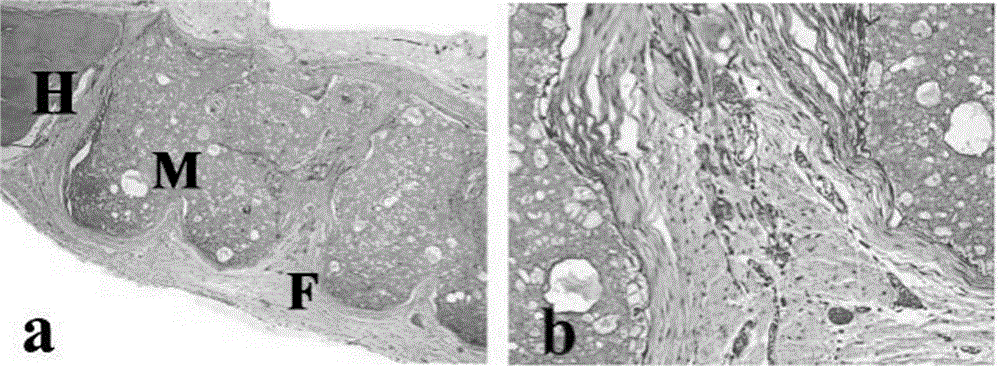 3D printing preparation method of bond defect repair stent