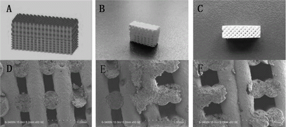 3D printing preparation method of bond defect repair stent