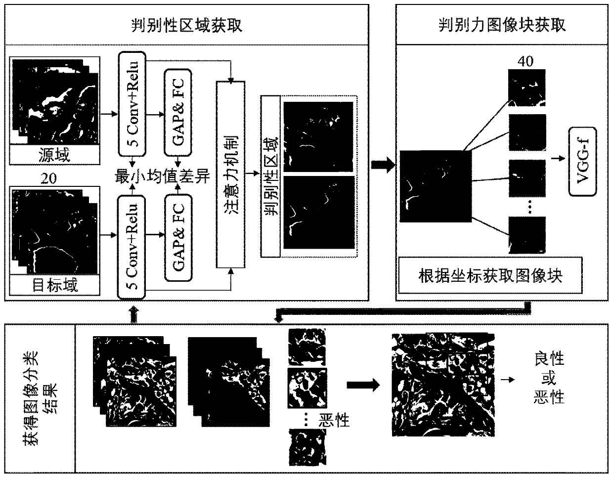 Papillary thyroid cancer pathology image classification method based on deep learning