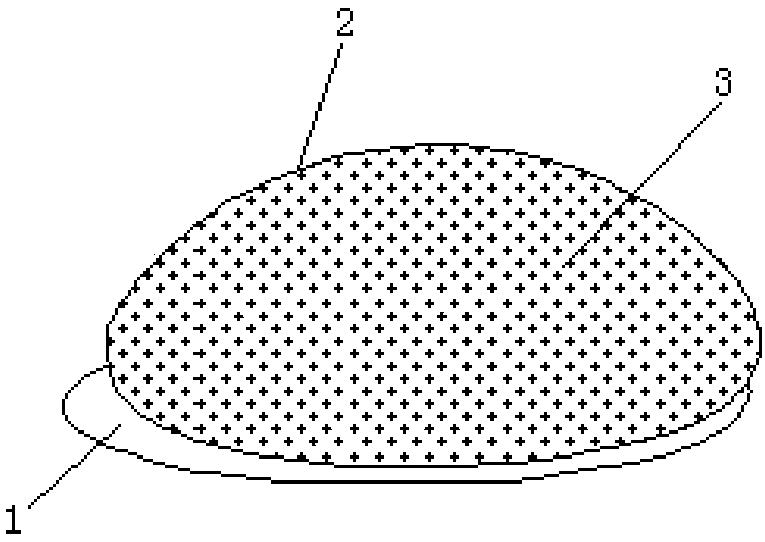 Breast implant silicone prosthesis capable of preventing movement