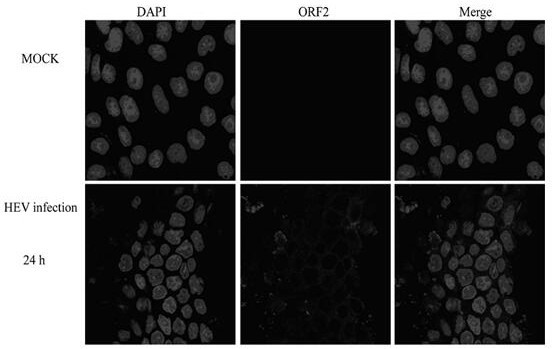 A kind of method for cultivating hepatitis E virus in vitro