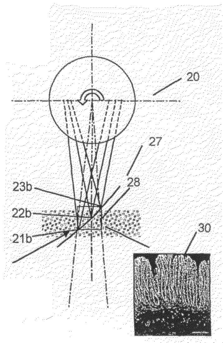 Method and apparatus for high resolution coherent optical imaging