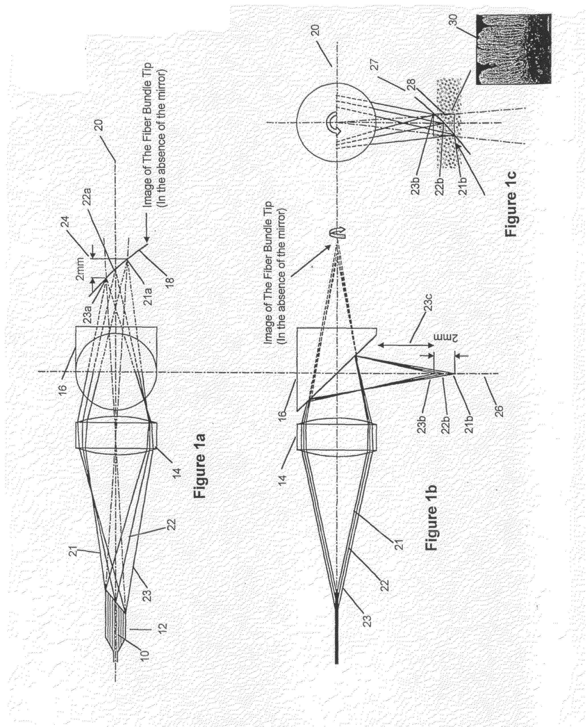 Method and apparatus for high resolution coherent optical imaging