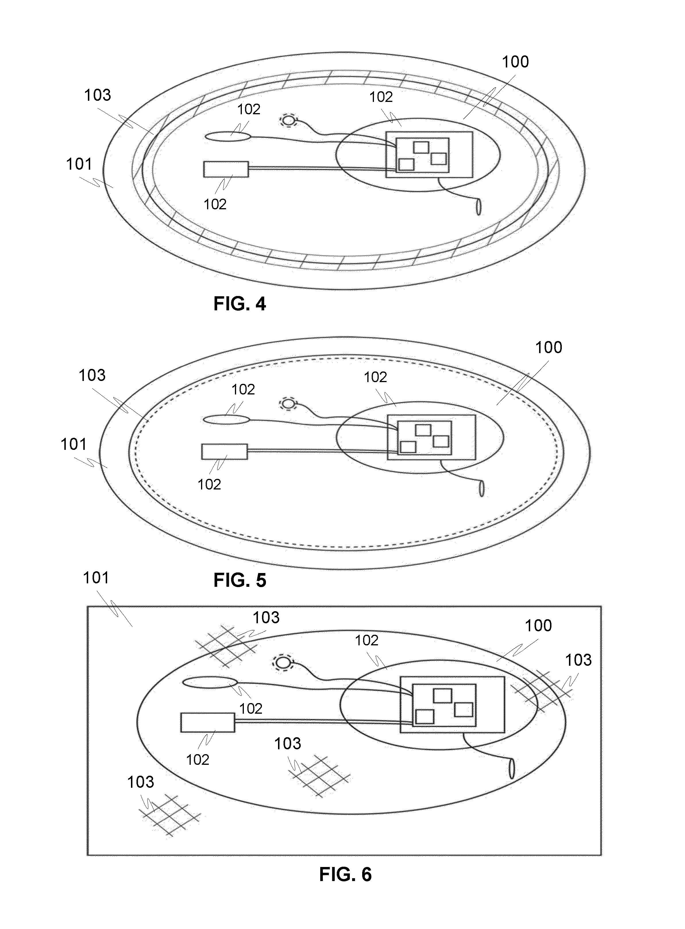 Module installable with a garment, the garment and the method