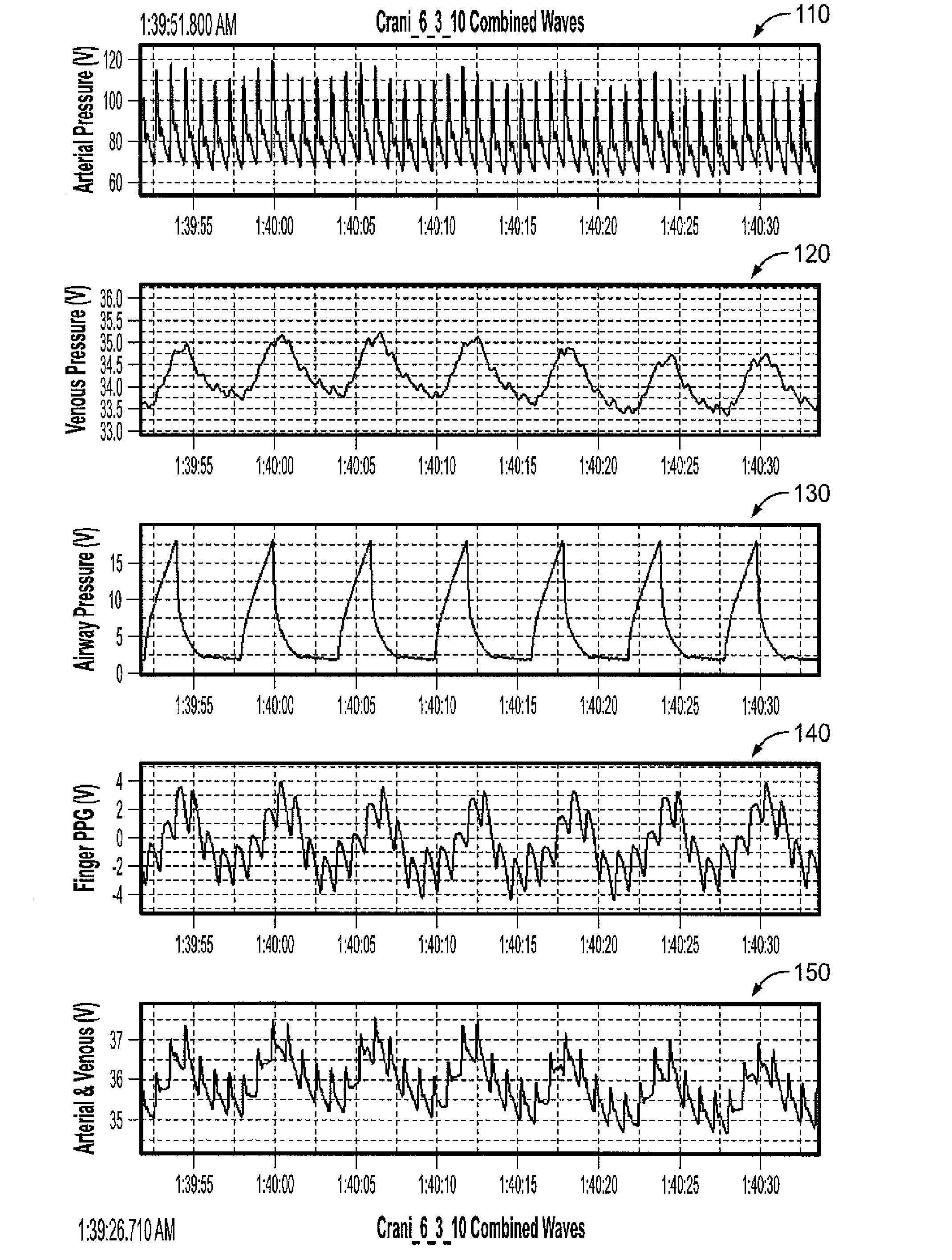 Apparatus, Systems and Methods Analyzing Pressure and Volume Waveforms in the Vasculature