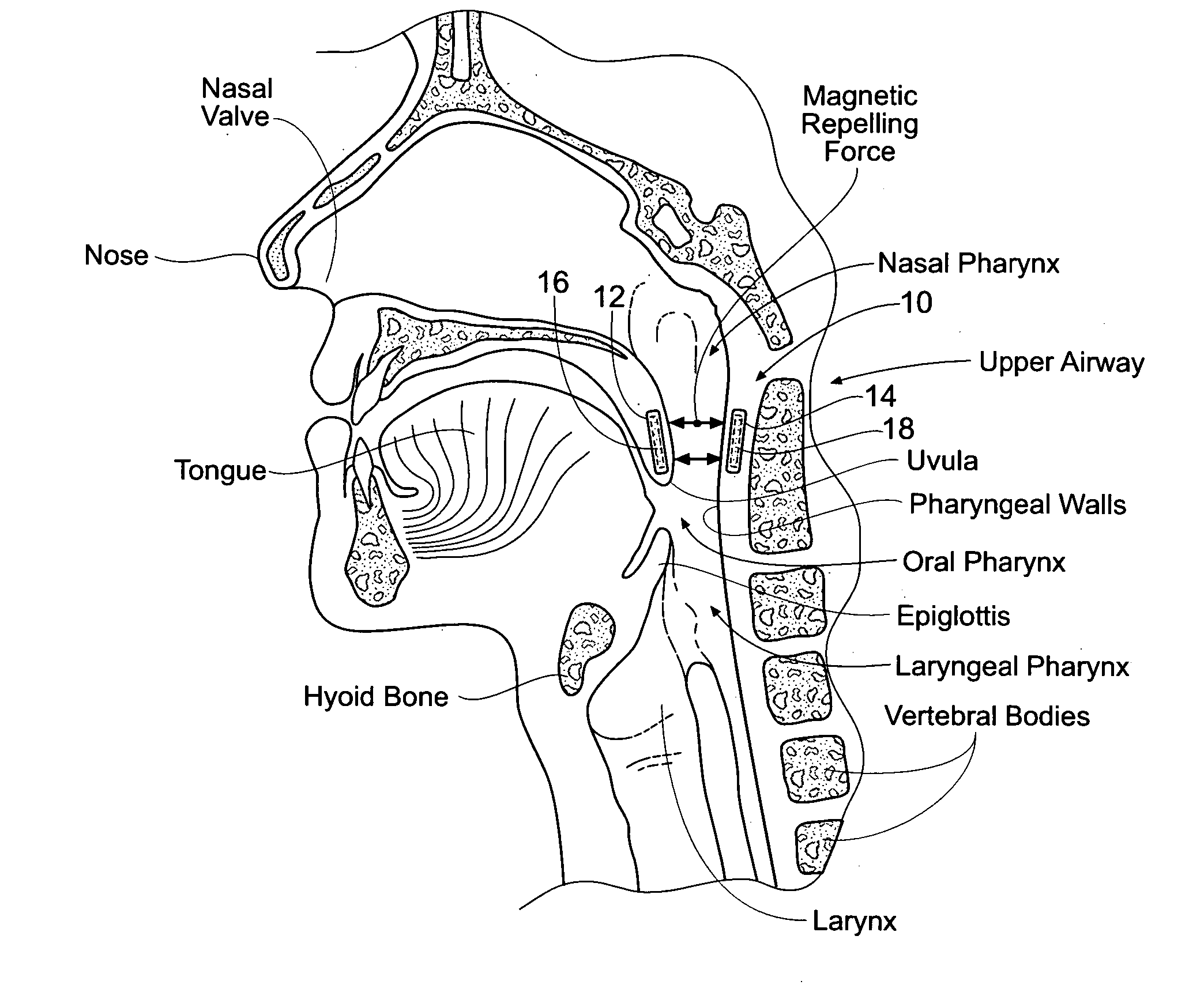 Devices, systems, and methods using magnetic force systems in or on tissue