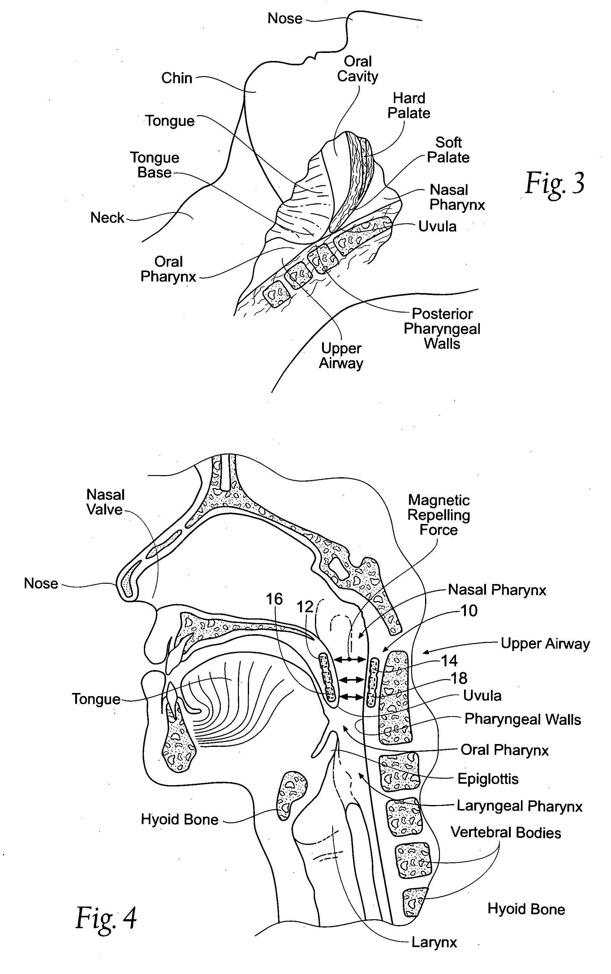 Devices, systems, and methods using magnetic force systems in or on tissue