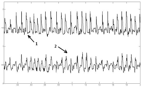 Network modeling method of cardiac mapping signals