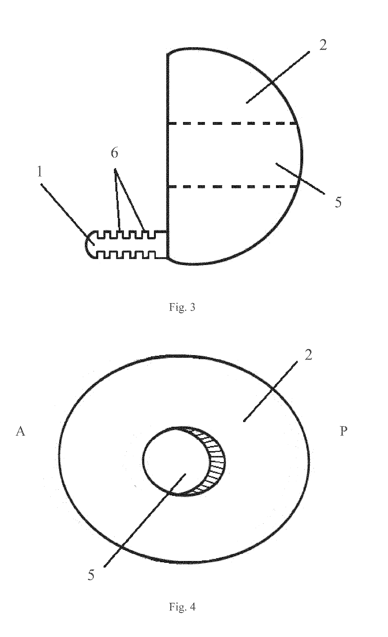 Compositions of Natural Extracts and Use Thereof in Methods for Preventing or Treating Diseases