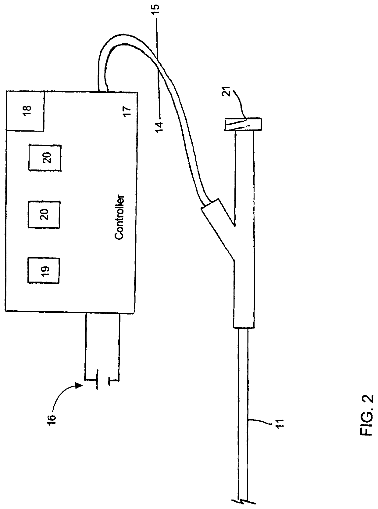 Selective Stiffening Catheter