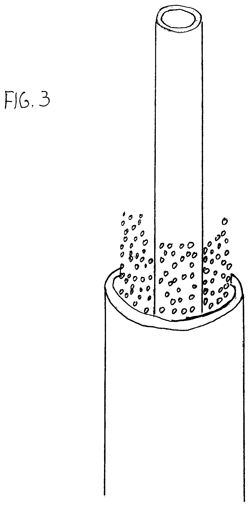 Selective Stiffening Catheter